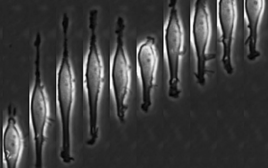 Mechanical confinement triggers glioma linear migration dependent on formin FHOD3