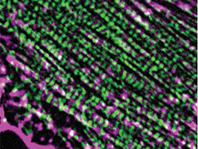 Reciprocal regulation of actomyosin organization and contractility in nonmuscle cells by tropomyosins and alpha-actinins