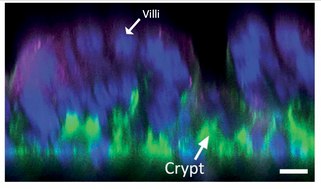 Human Microphysiological Models of Intestinal Tissue and Gut Microbiome