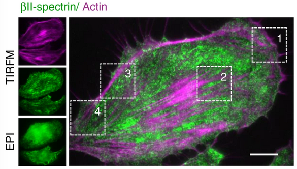 Complementary mesoscale dynamics of spectrin and acto-myosin shape membrane territories during mechanoresponse