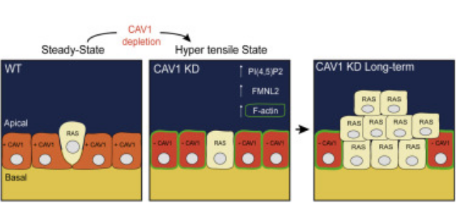 Caveolae Control Contractile Tension for Epithelia to Eliminate Tumor Cells