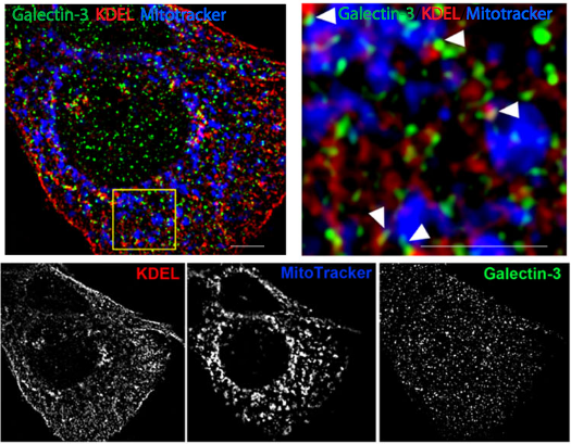 Galectin-3 modulates epithelial cell adaptation to stress at the ER- mitochondria interface