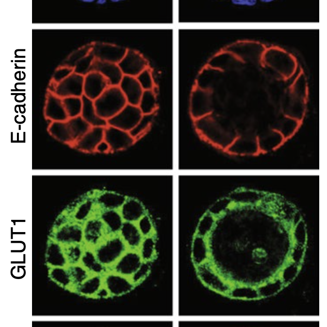 Ankyrin G organizes membrane components to promote coupling of cell mechanics and glucose uptake