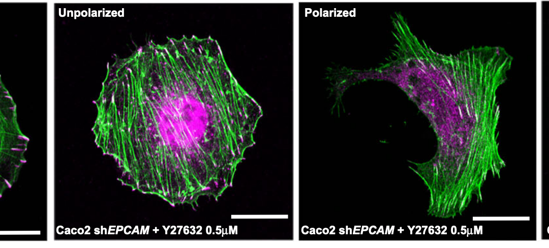 EpCAM promotes endosomal modulation of the cortical RhoA zone for epithelial organization