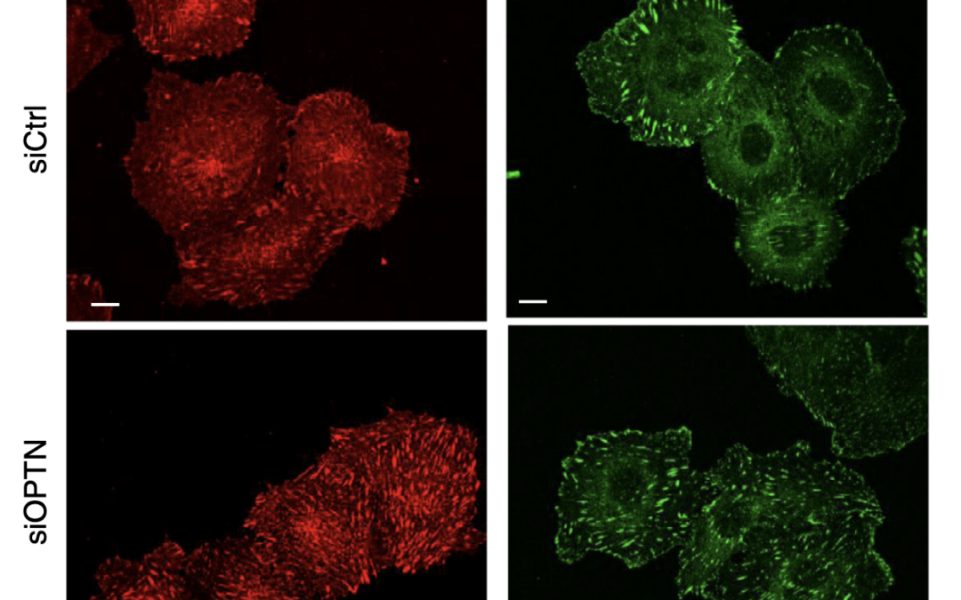 Optineurin links Hace1-dependent Rac ubiquitylation to integrin-mediated mechanotransduction to control bacterial invasion and cell division